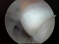 Michael Shepard - Arthroscopic Surgery