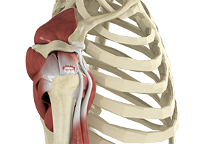  Rotator Cuff Tear 