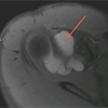 MRI Before Release