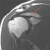 MRI Before Release