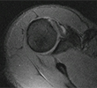 MRI Before Release