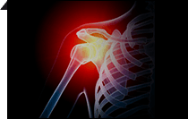 Shoulder Condition and Procedure