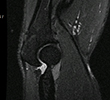 MRI Before Release