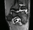 MRI Before Release